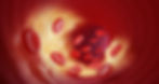 red-blood-cells-leak-into-arteries-veins-through-cholesterol-plaque-3d-illustration.jpg
