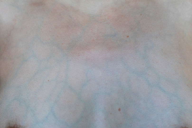 Nahaufnahme von Adern einer stillenden Brust