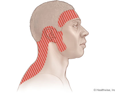 headaches.jpg