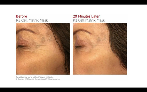 Dr LEVY R3 Cell Matrix Mask - 50ml | Secret Surgeon