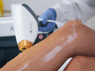 Laser Hair Removal in Vienna: Your Questions Before the First Appointment