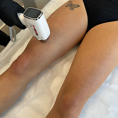 Epiliation-Laser-La-Côte-Saint-André