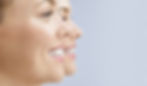 Invisalign Eligible