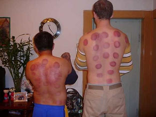 suction cup fail