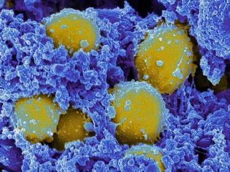 Infecções estafilocócicas