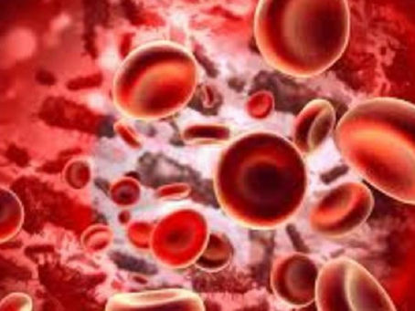 Anemia Perniciosa - Tem como causa a falta da Vit. B12.