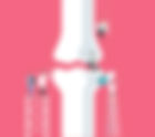 A potential solution to morbidities associated with Rheumatoid arthritis., Press Information Bureau,