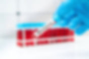 Malaria to become notifiable disease across India