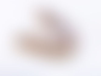 Nexus Dentures are the Gold Standard for Tooth Replacement