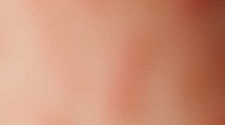 KROSTKI PO GOLENIU - JAK POMÓC SWOJEJ SKÓRZE ?