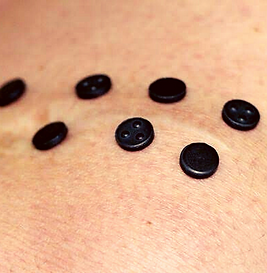 Técnicas com Magnetos