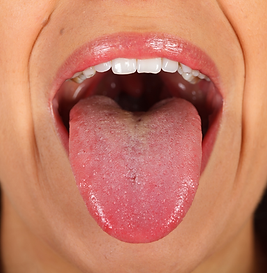 Avaliação da Língua