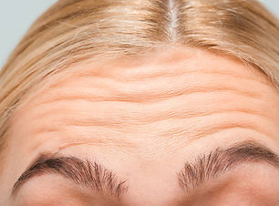 Forehead.jpg