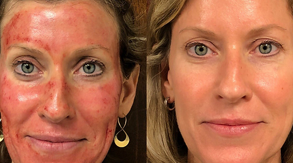 Before and After Treatment