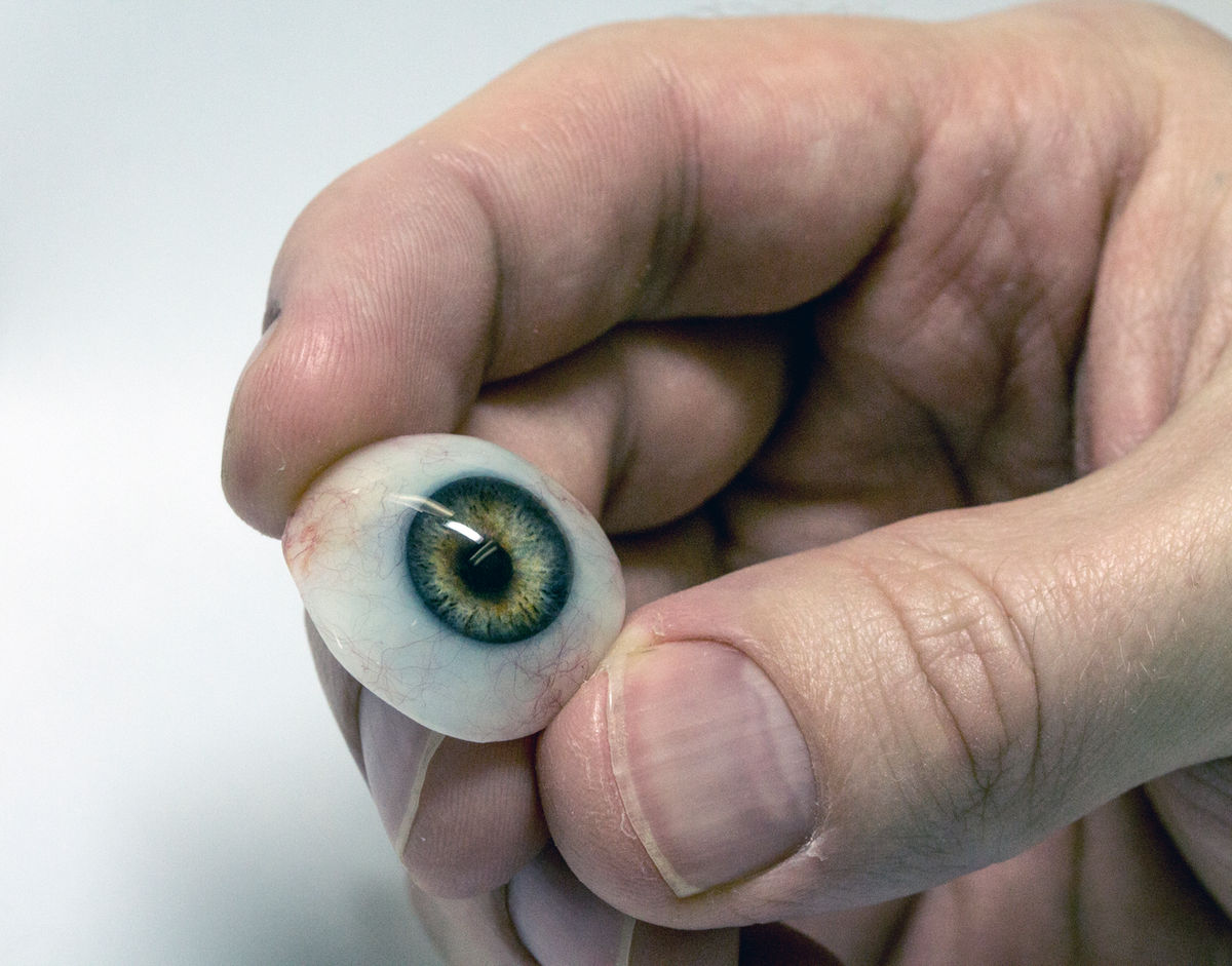The Center for Alloplastic Facial Reconstruction