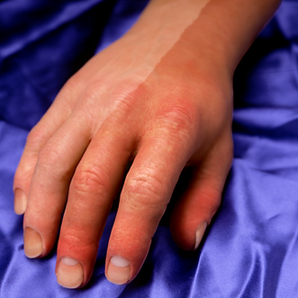 half-tanned-hand-prosthesis-removable-tan.png