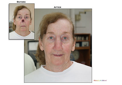nose_b4_after4b-1.jpg