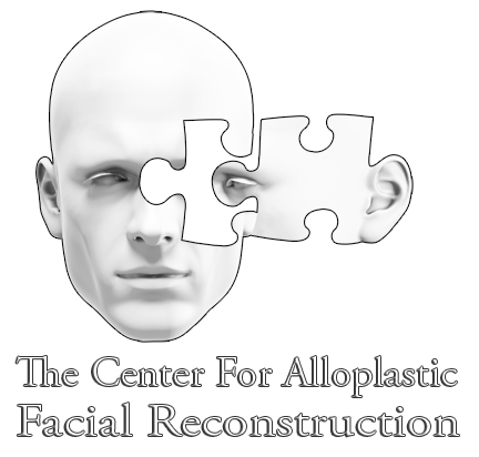 The Center for Alloplastic Facial Reconstruction
