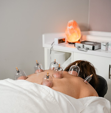 Cupping North Vancouver