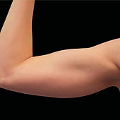 Body Contouring 3_edited.jpg