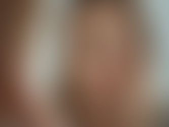 Say Goodbye to Puffy Eyes: Natural Ways to Reduce Eye Puffiness