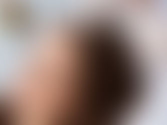 Can PRP Really Regrow Hair or Is It Just Hype With a Fancy Name ?