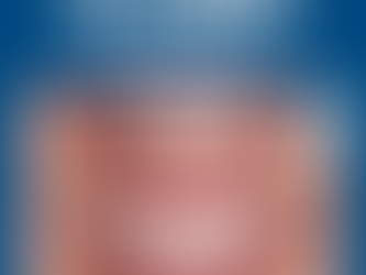 DIY teeth whitening facts