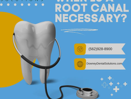 Root Canal