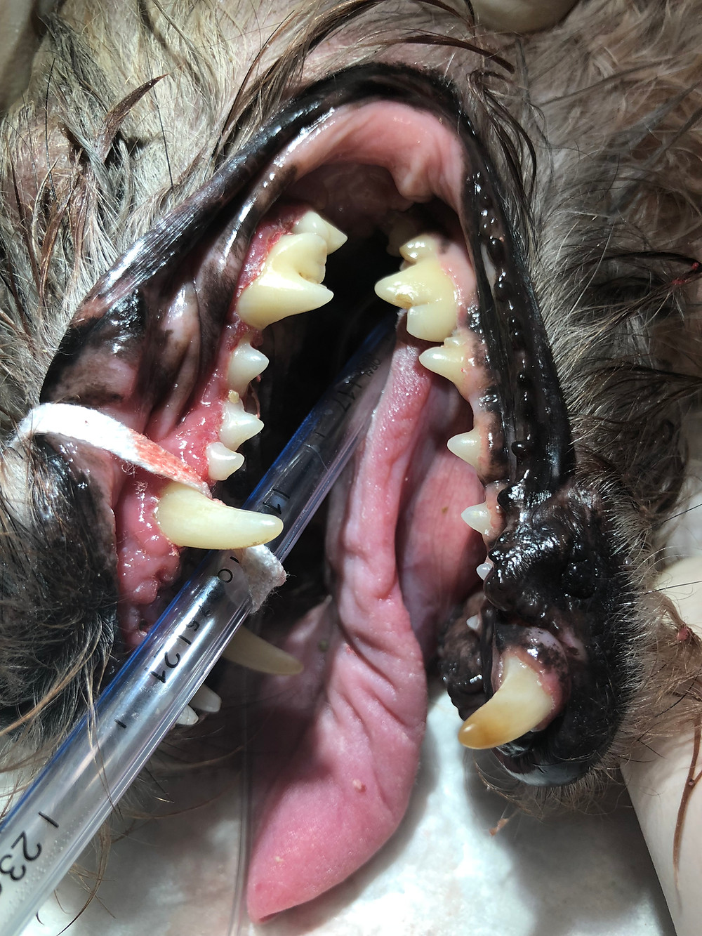 Hannah's teeth after