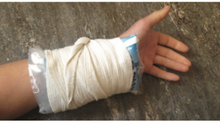 SELF TEST: Can You Diagnose the 3 Most Common Wrist Pains with Climbing?