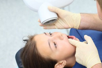 Intra Oral Peri Apical Radiograph on Child patient