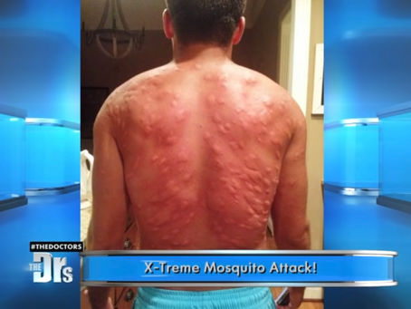 Extreme mosquito attack!