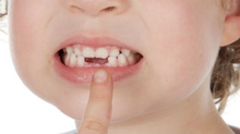 ¿Por qué perdemos los dientes de leche?