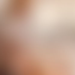 How to Prepare for Your Acupuncture Session for Pelvic Pain