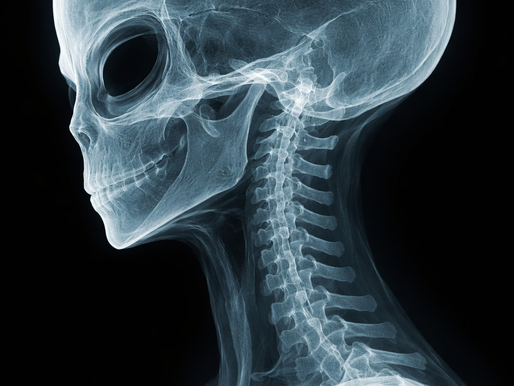 Front Headlock Month: How to Build a Stronger, Healthier Neck for Jiu Jitsu, Wrestling, and MMA