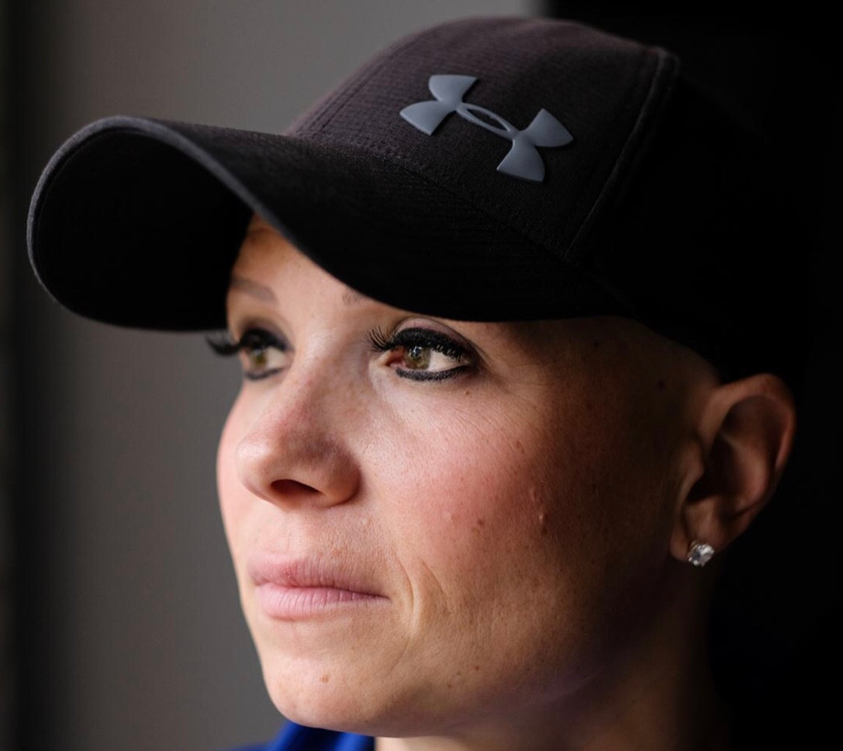Alopecia areata bald hair loss mother mom wig wigs motivational speaker public speaker