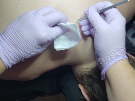 A facial for your back?