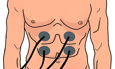 ELECTROESTIMULACIÓN.jpg