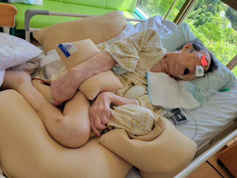 延命治療を受けている患者と実際の現場