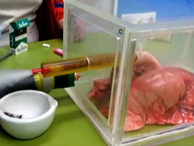 Esto le pasa a tus pulmones cuando fumas (Video)