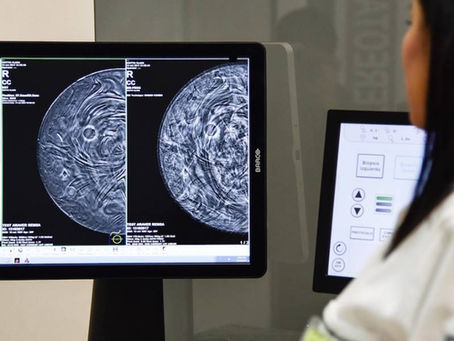 Gastos por cáncer llegan hasta 90 mdp, por paciente: AMIS