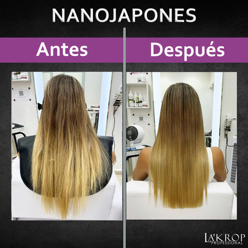 Cirugía Capilar El Alaciado Japones Funciona Alaciado Nanojaponés