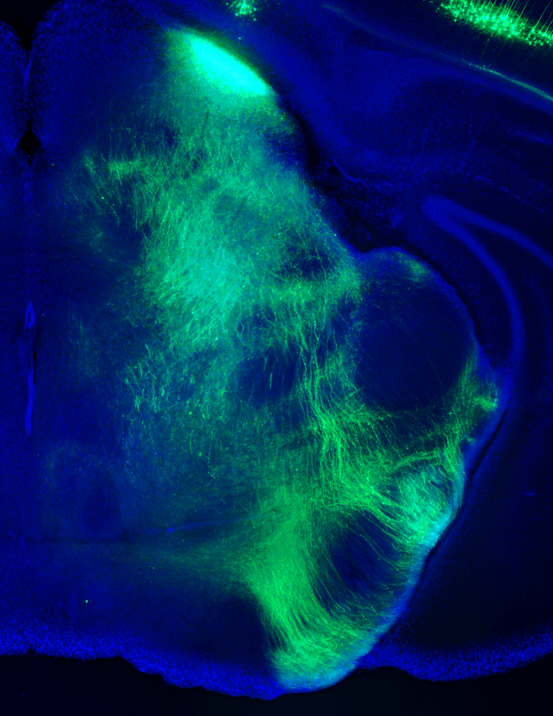 SC Axonal Waterfall