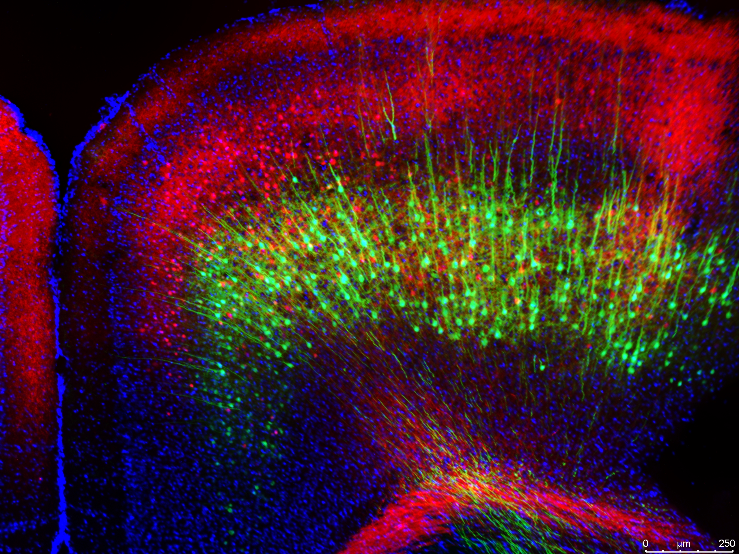Whisker Motor Cortex