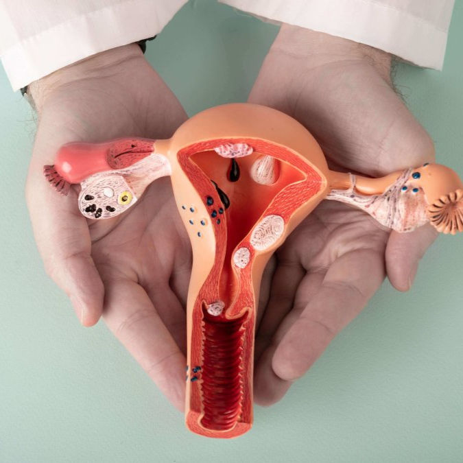 Preventivo - Papanicolau