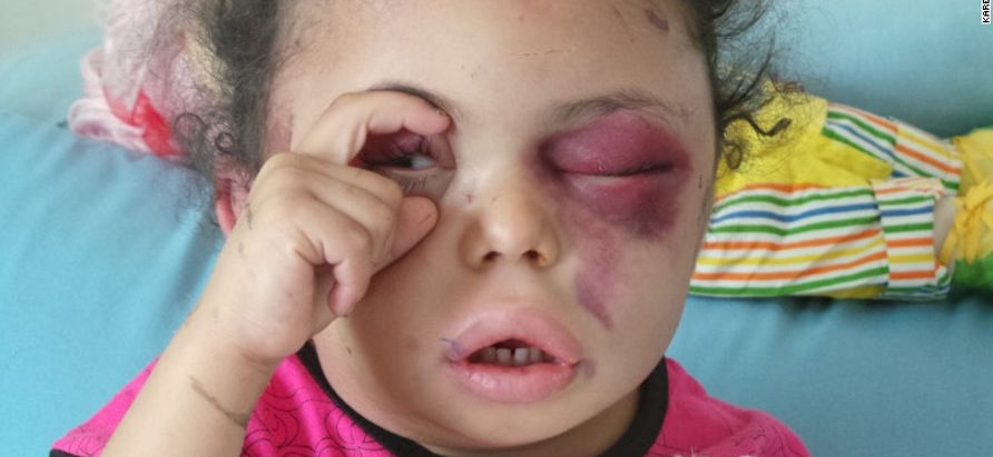 Yemen nel suo quarto anno di guerra