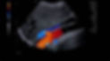 Aorta Color Doppler.jfif