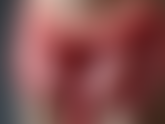 Prostate Cancer Awareness is Rising Why Biden's News is Sparking a Search Surge