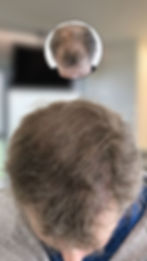 mhp haar verdichting.jpg