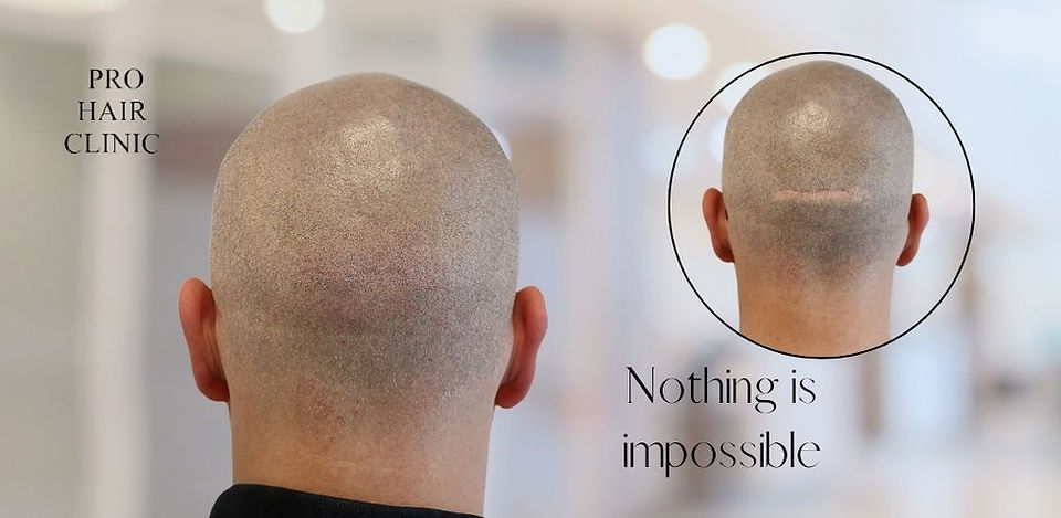 MHP Before and after photos